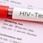 جدیدترین وضعیت بیماری HIV در ایران
