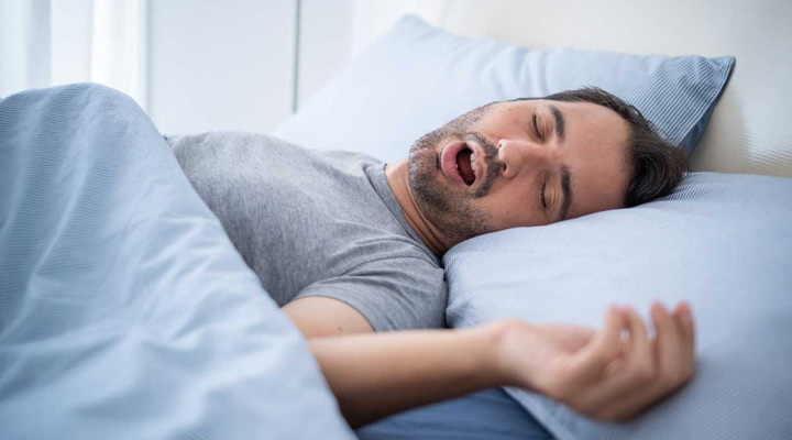 انحراف بینی؛ هرآنچه باید بدانید 5 ارتباط انحراف بینی و آپنه خواب